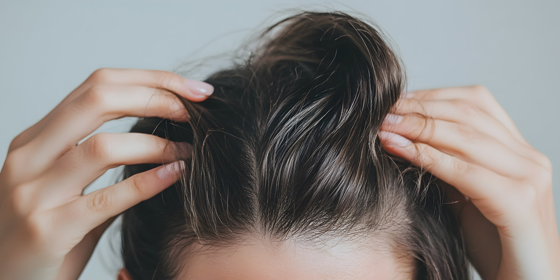 O melhor shampoo para dermatite seborreica